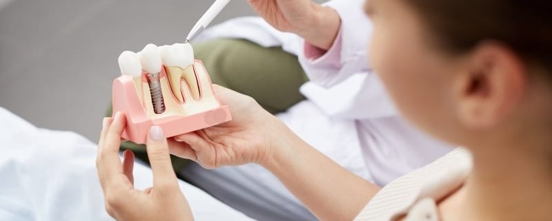 Implant dentar Timișoara – tratament sigur și natural la Imperial Dent
