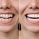 servicii stomatologice complete Timișoara – zâmbet sănătos și natural