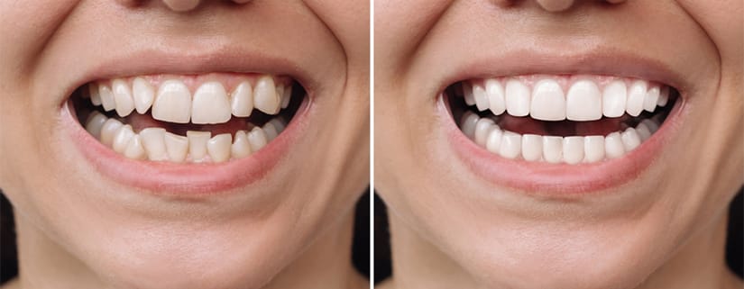 servicii stomatologice complete Timișoara – zâmbet sănătos și natural
