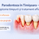 Parodontoza în Timișoara – simptome și tratament la Imperial Dent Clinic