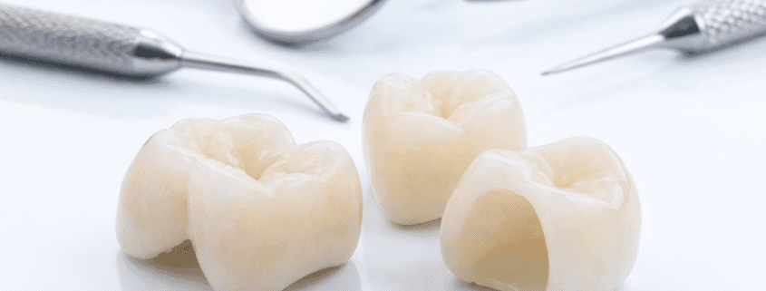 Coroane din zirconiu realizate digital la Imperial Dent Clinic Timișoara