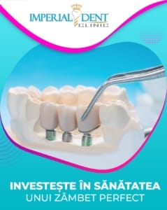 coroană pe implant dentar Timișoara – lucrare fixă pe implant