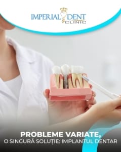 implant dentar explicat pacientului în clinica stomatologică din Timișoara