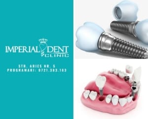 implant dentar explicat în clinica stomatologică din Timișoara
