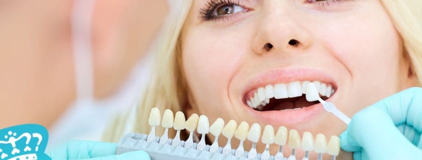 Aplicare fațete dentare ceramice la pacient în Timișoara