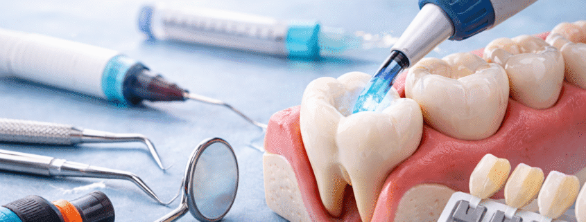 plombă dentară în Timișoara – tratamentul cariilor