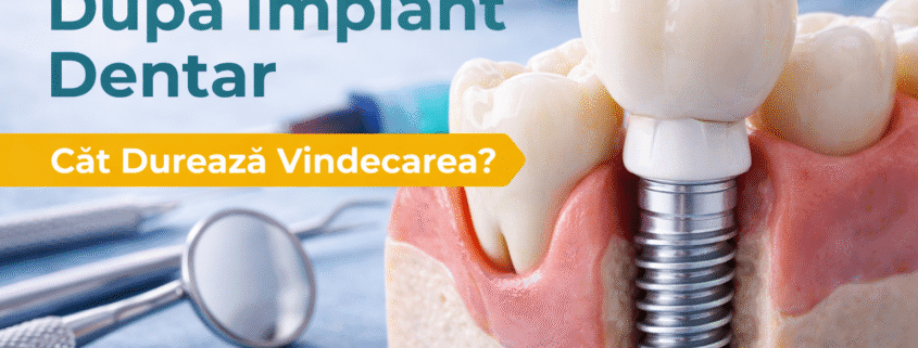 vindecarea dupa implant dentar si procesul de osteointegrare