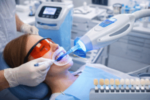 tratament albire dentara realizat in cabinet stomatologic procedura profesionala