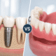 implant dentar sau proteză mobilă comparație tratamente dentare Timișoara