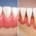 retracții gingivale comparație între gingie sănătoasă și gingie retrasă