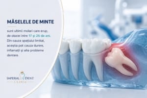măsea de minte inclusă Timișoara ilustrație 3D