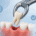 Extracție dentară Timișoara – ilustrație procedură de extracție dentară